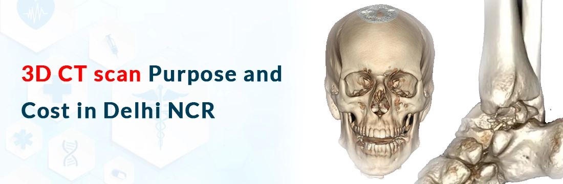 3D CT scan: Purpose and cost in Delhi NCR